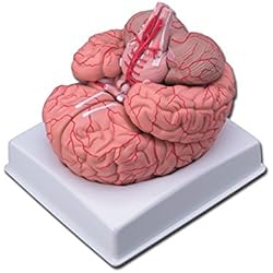 Modelo cerebro con Arterias