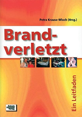 Download Brandverletzt: Ein Leitfaden Download Brandverletzt: Ein Leitfaden