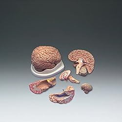 cerebro con arterias