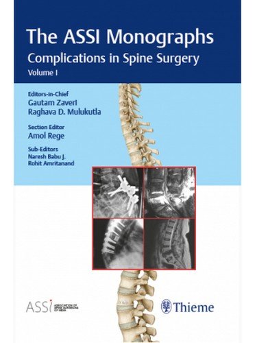 The ASSI Monographs-Complications in Spine Surgery: Complications in Spine Surgery - Vol. 1