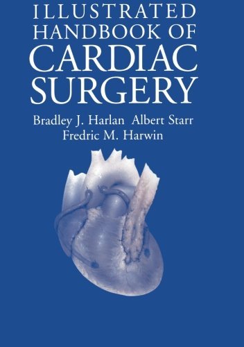 Illustrated Handbook of Cardiac Surgery (Applied Mathematical Sciences; 109) by Bradley J. Harlan (1995-08-30)