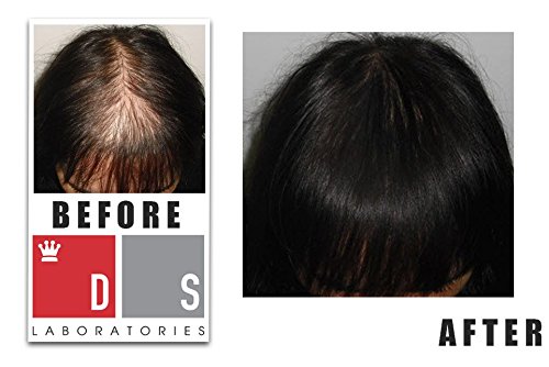Spectral.DNC-N – mit 5 Prozent Nanoxidil gegen Haarausfall I Mittel gegen dünne Haare I Effektives Spray gegen Haarverlust I Für Frauen und Männer geeignet - 4