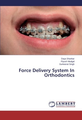 Force Delivery System In Orthodontics