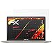 Price comparison product image atFoliX Protector Film compatible with Asus VivoBook Pro 15 N580VD Screen Protection Film, HD antireflection coating FX Screen Protection (2X)