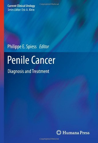 Penile Cancer: Diagnosis and Treatment (Current Clinical Urology) by Philippe E. Spiess (Editor) (8-Mar-2013) Hardcover