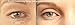 Lids by Design - Medical Grade Instant Eyelid Correcting Strips 7mm 80 strips