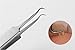 1Set(2PCS)Professional Stainless Steel Blackhead Needle Kit Zit Pimple Comedone Extractor Tools Fat Granule Removal Kit With Metal Case for Acne Treatment and Blemish Removal Whitehead Popping (A)