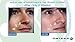 Omiera Labs Facial Hair Inhibitor & Acne Spot Treatment Cream and Cleanser 3Pc Skin Care Set