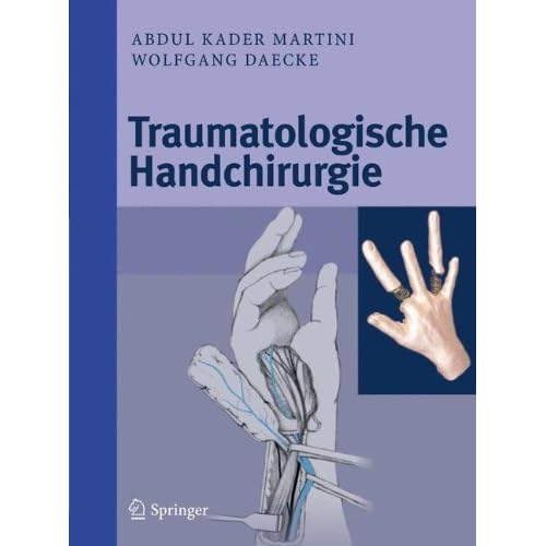 Pdf Traumatologische Handchirurgie Kostenlos Download - 