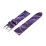 IGEMY Sternenhimmel Mikrofaser Lederband Ersatzband für Fitbit Versa 5.0'-7.8' (127mm-200mm) (Rosa)