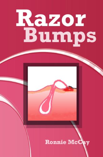Razor Bumps Prevent Bikini Area Razor Bumps Treat Ingrown Hair