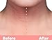 NEW on Amazon UK! BESTSELLER in Germany! Silicone care Neck Pad to eliminate and prevent neck wrinkles!
