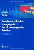 Image de Doppler- und Duplexsonographie der hirnversorgenden Arterien