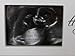 Baby Scan Wooden Photo Frame - With Bunny Gift Tag (Love At First Sight)