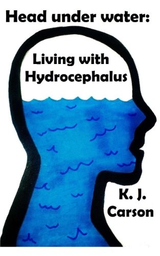 Download Head under water: Living with Hydrocephalus Download Head under water: Living with Hydrocephalus