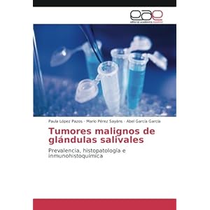 Tumores malignos de glándulas salivales: Prevalencia, histopatología e inmunohistoquímica