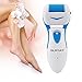 Quimat Pedicure Hard Skin Remover Rechargeable Foot File Electric Callus Remover Foot Care Tool with 1 Free Roller to Gently and Instantly Removes Hard Cracked Dead Skin for Smooth Feet Fast (Blue)