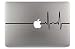 Produktbild Pulsschlag EKG Alive Apple MacBook Air Pro Aufkleber Skin Decal Sticker Vinyl (13")