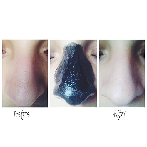 Original Deep Black Head Maske gegen Mitesser und Hautunreinheiten 50 gr – Peel of Maske, Mitesser Entfernung by BLISSANY - 6