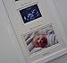 Unisex, Newborn Baby Triple Scan Photo Frame 20 x 8 (White mount - cream inner border)