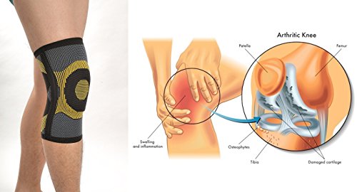 New Elastic Knee Medical Support Sleeve with 2-Bilateral Flexible Stays for Extra Compression & Protection - Patella Knee Support/Brace for Arthritis, Bursitis & Tendinitis by Solace Care (S)