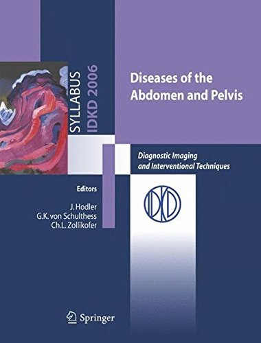 Diseases of the abdomen and Pelvis: Diagnostic Imaging and Interventional Techniques (Syllabus) (English Edition)