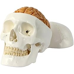 Cráneo humano con cerebro