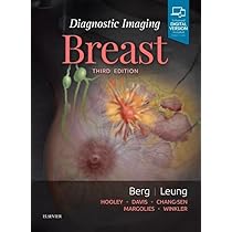 Buy Diagnostic Imaging Breast With Access Code 3Ed (Hb 2019