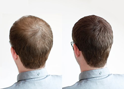 Relight Haarfasern – natürlicher Look dank natürlicher Formel. Volles Haar in Sekunden! (dunkelbraun) Haaverdichtung Schütthaar - 4