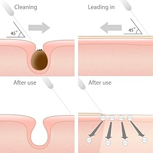 LifeBasis Ultrasonic Face Skin Scrubber Spatuala Portable Blackhead Spatula, Peeling Wrinkle Removal Machine Facial… - Image 6