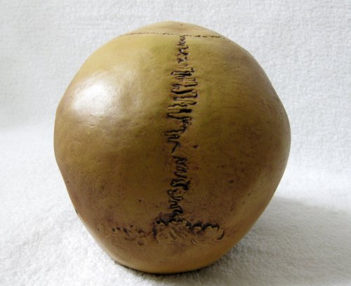 Anatomie Schädel mit Unterkiefer von Markus Mayer - 3