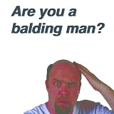 Image de Are You A Balding Man? (English Edition)