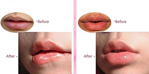 10 Stück Lippe Maske, Collagen Lippe Gel-Maske, Kollagen-Kristall Lippe Film Paste/Lippenpads, CIDBEST® Beauty Make-up Lippenpflege Zubehör, Anti Dry Ageing Falten Membrane Moisturizing Lip Mask, Machen Sie Ihre Lippe attraktiv und Sexy - 7