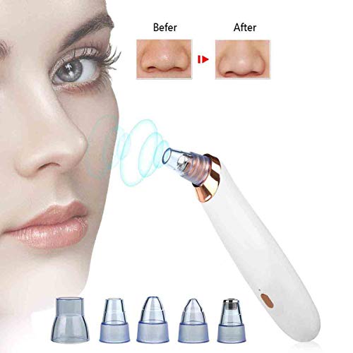 Limpiador De Poro Electrico,Removedor De La Espinilla Removedor De succión De Vacío De Espinilla Recargable Aguja Extractor para Acné Facial De Limpieza Del Acné (unisex)