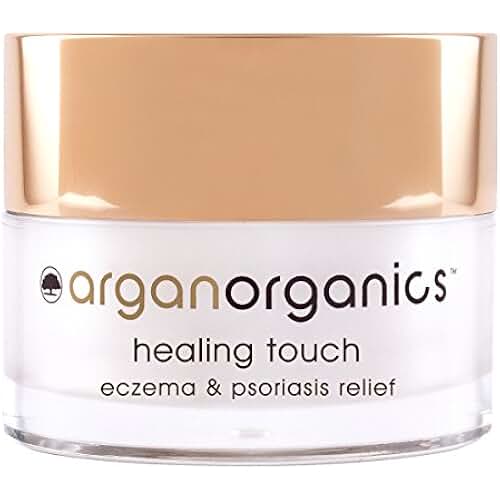 Amazon.co.uk natural psoriasis cream