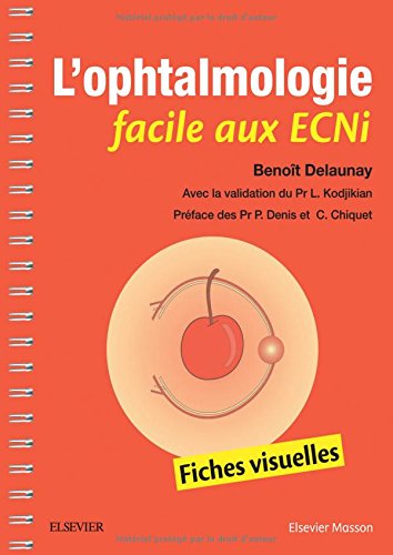 Télécharger L'ophtalmologie facile aux ECNi: Fiches visuelles Gratuit