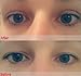 1000PCS Portable Breathable Naturally Invisible Double Eyelid Tapes Self-Adhesive Stickers With Packing Case Mirror Instant Eye Lift Strips