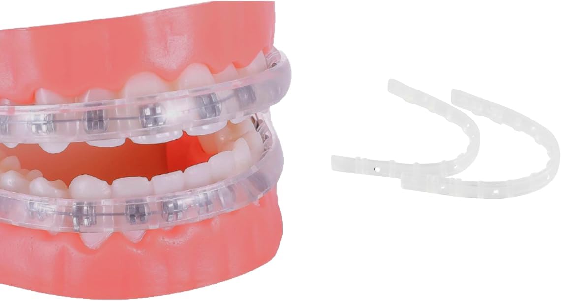 Protector de labios para brackets, protector bucal ortodóntico para brackets, alternativa a la cera, fundas cómodas para brackets, protector labial para brackets, tope labial para brackets