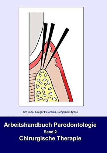 Preisvergleich Produktbild Arbeitshandbuch Parodontologie: Band 2 Chirurgische Therapie