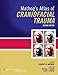 Produktbild Mathog's Atlas of Craniofacial Trauma