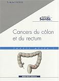 Image de Cancers du côlon et du rectum