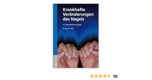 Krankhafte Veranderungen Des Nagels Zaun Hansotto Dill Dorothee Amazon De Bucher 