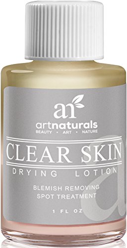 ArtNaturals Acne Spot Remover Treatment - Clear Skin Drying Lotion for Fast Drying - Shrinks Whiteheads and Fades Out Face Blemishes - 29 ml.