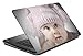 meSleep Baby Laptop Skin RS.189.00