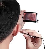 Endoscopio multi-función del oído: tanto el canal auditivo como el tímpano, la boca, las encías, la garganta, la cavidad nasal, las raíces del cabello del cuero cabelludo y otras partes del cuerpo..