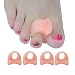 Produktbild Welnove Zehenspreizer, 10x Gel Zehenstrecker für Hallux Valgus Korrektur, überlappende Zehen (Beige Silikon Zehentrenner)