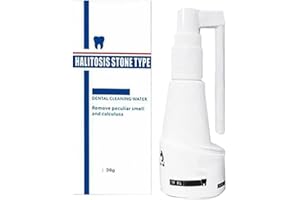 OFANYIA Dissolvant de tartre dentaire Polissage des dents Nettoyage Enlèvement des taches Spray de blanchiment des dents Spray de dissolution du tartre dentaire Utile pour éliminer le tartre et la plaque
