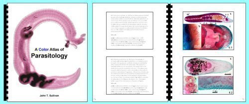 A Color Atlas of Parasitology, 7th Edition by John T. Sullivan (2007-08-02)