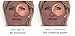 Deluxe DermaWand Anti-Aging System (UK Plug) - With 2 Essential Creams to REDUCE WRINKLES!