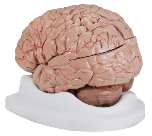Budget Brain With Arteries Model by Anatomical Chart Company